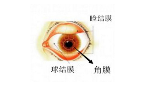 深圳眼科医院:角膜炎与结膜炎不一样,这两种眼表炎症别再弄错了!