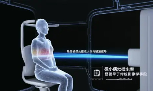 人工智能科技赋能女性乳腺健康