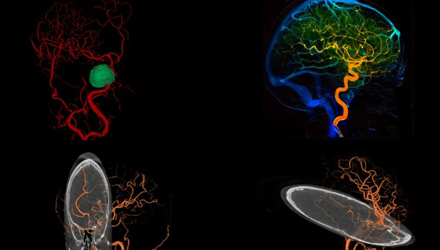 黑马破局！万东稀土悬吊DSA即将上市，挑战进口垄断