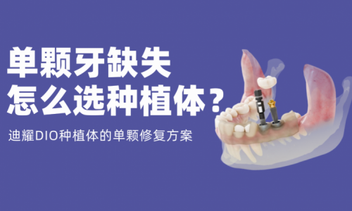 单颗牙缺失怎么选种植体？迪耀DIO种植体的单颗修复方案